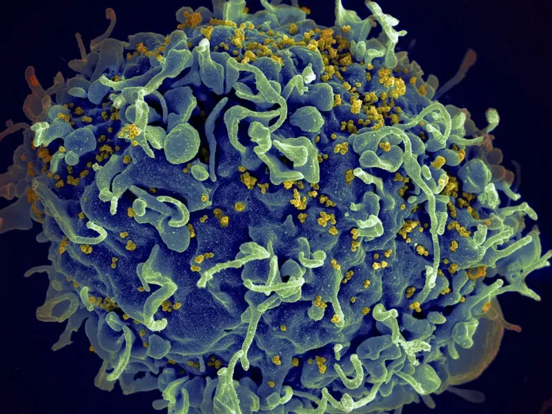 New HIV Drug Approved in Europe