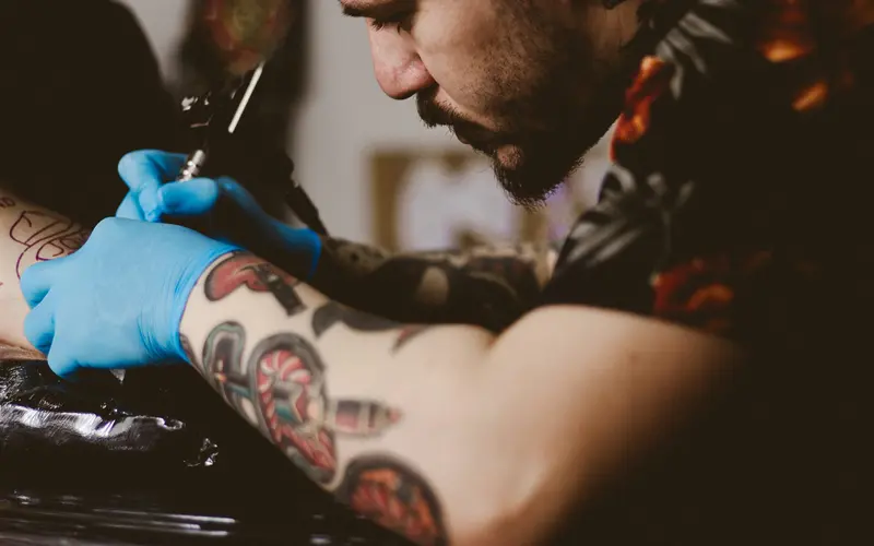 The Painful and Costly Process of Tattoo Removal