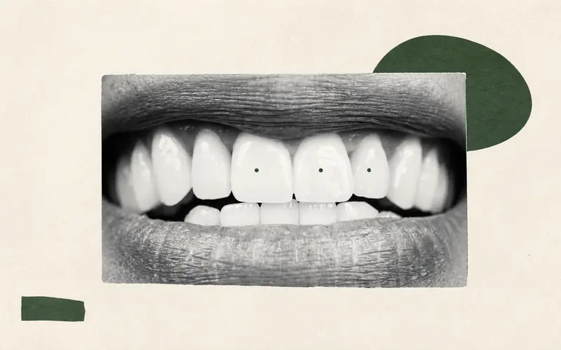 Can Food Help Your Mouth’s Good Bacteria?